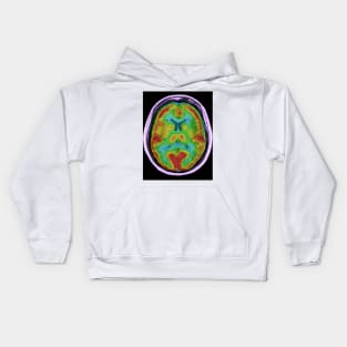 Normal brain blood flow, MRI and SPECT (C026/8000) Kids Hoodie